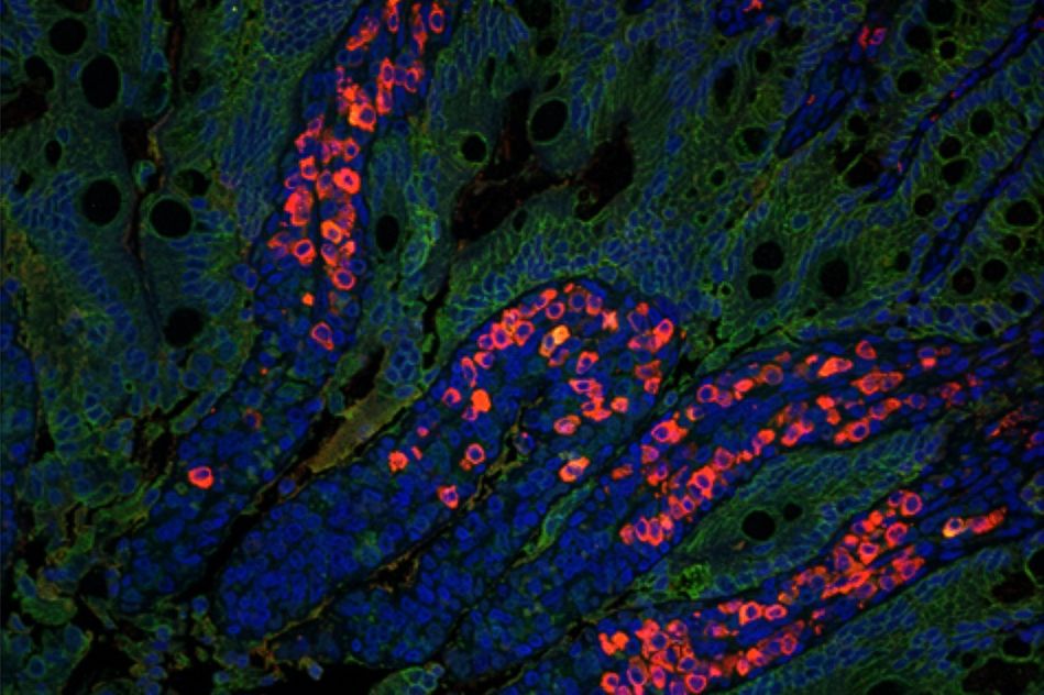 Nova tecnologia de nanopartículas promete acelerar erradicação da pólio