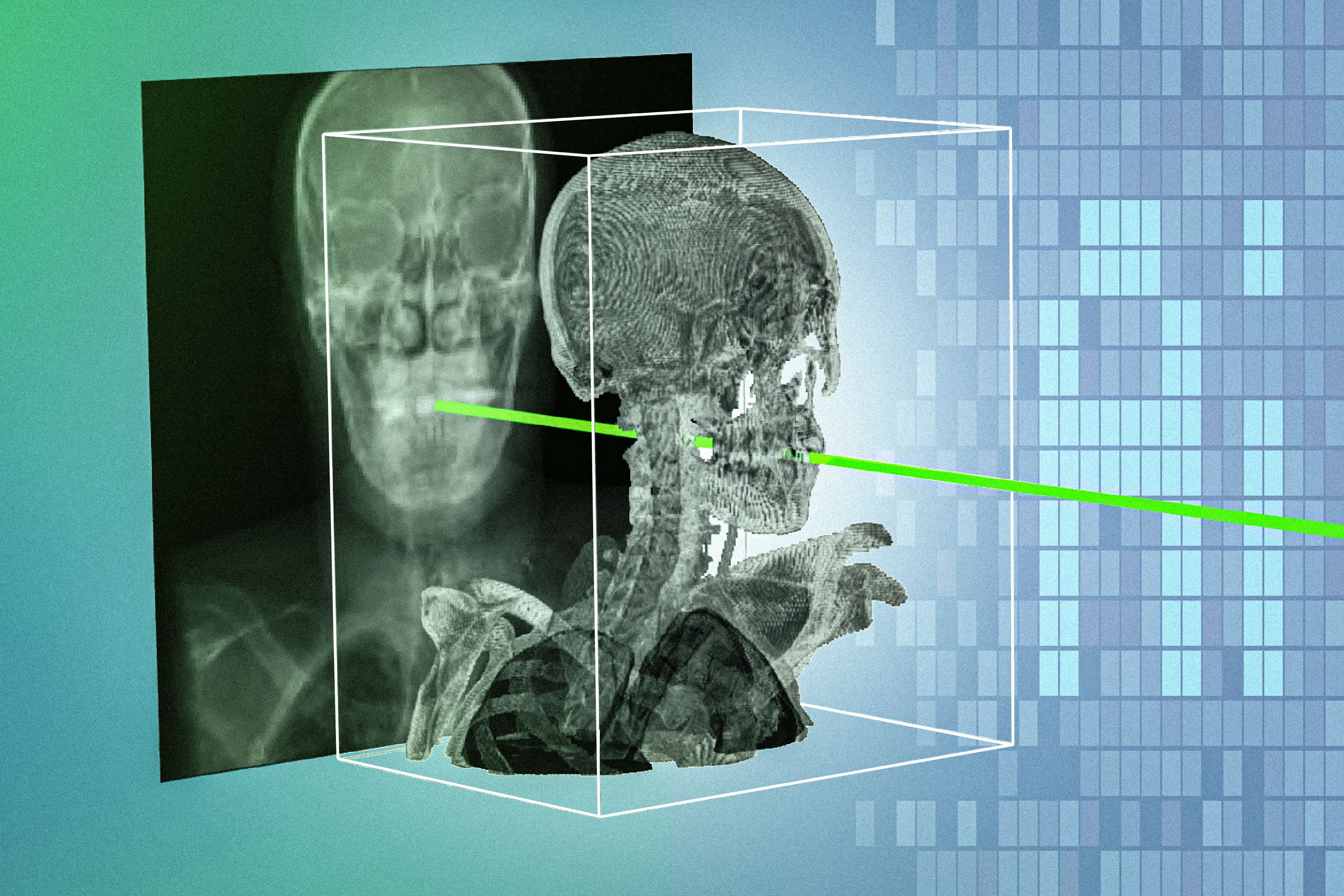 O GPS do corpo humano: a IA do MIT que guia o cirurgião