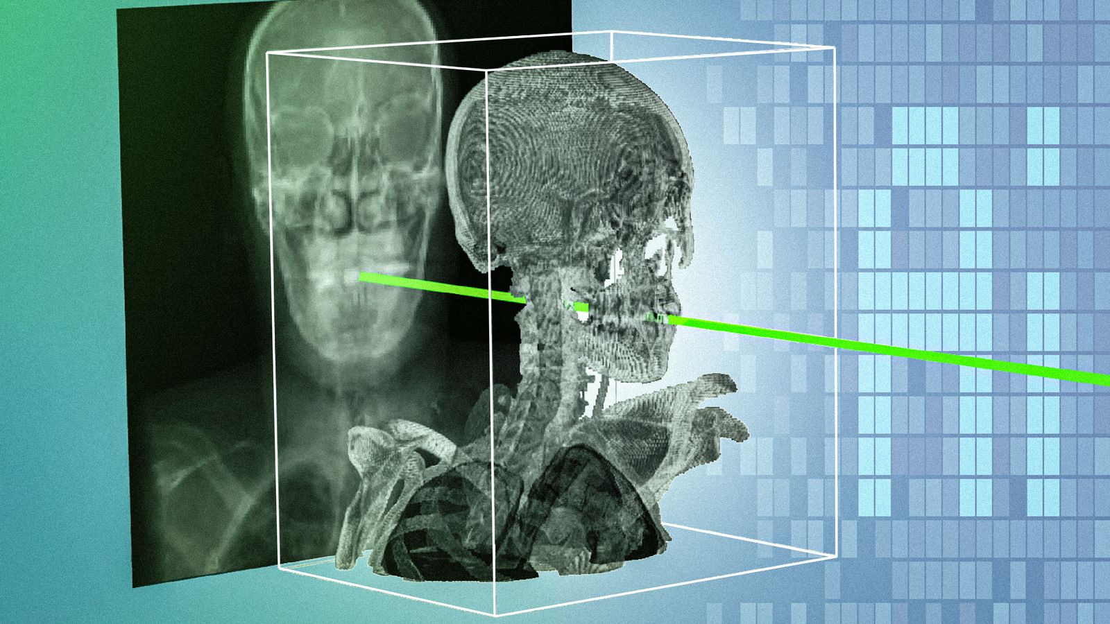 O GPS do corpo humano: a IA do MIT que guia o cirurgião