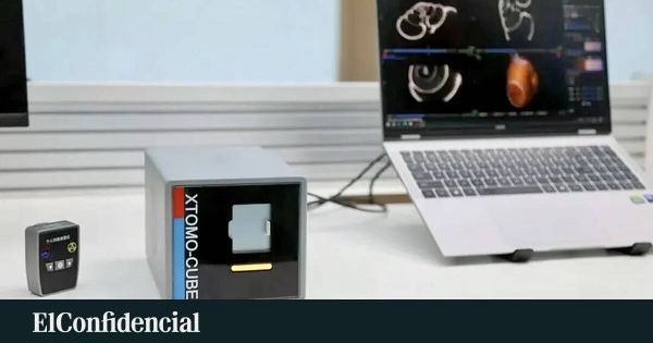 China coloca um tomógrafo na palma da mão