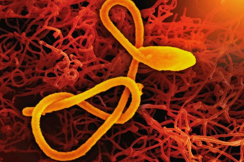 Ebola ressurge com uma cepa que a ciência não sabe como parar