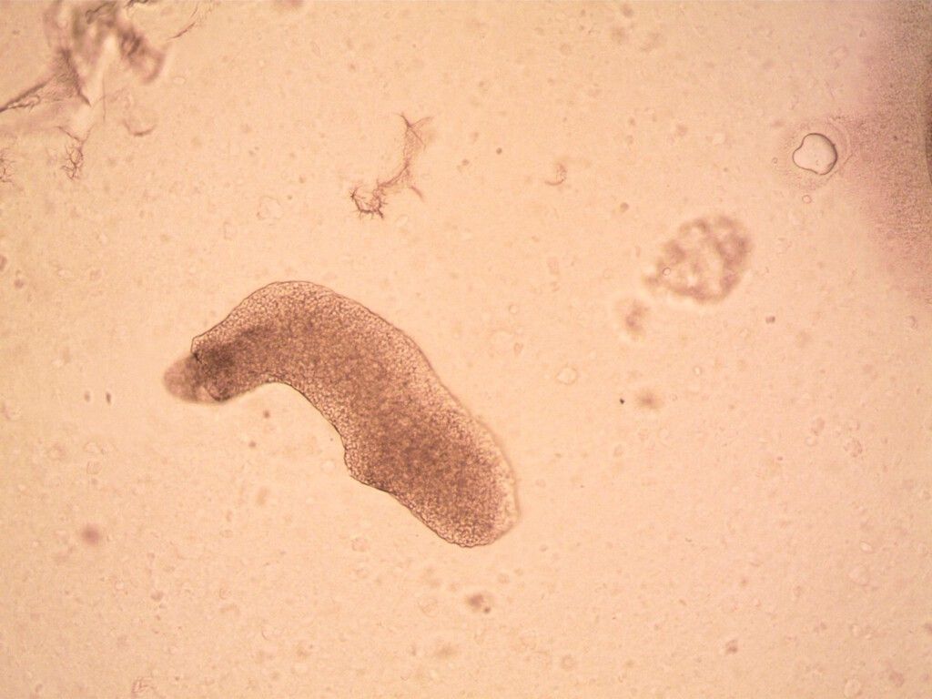 Amebas em motel revelam segredo da origem das plantas