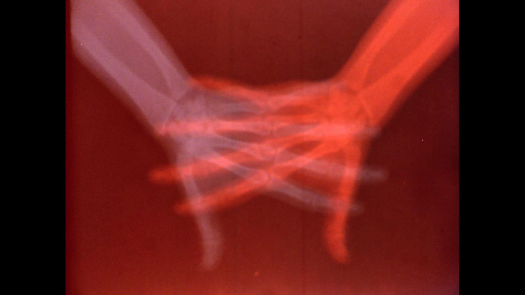 Arte e Imagem Médica: Exposição Revela Corpo Sob Nova Luz