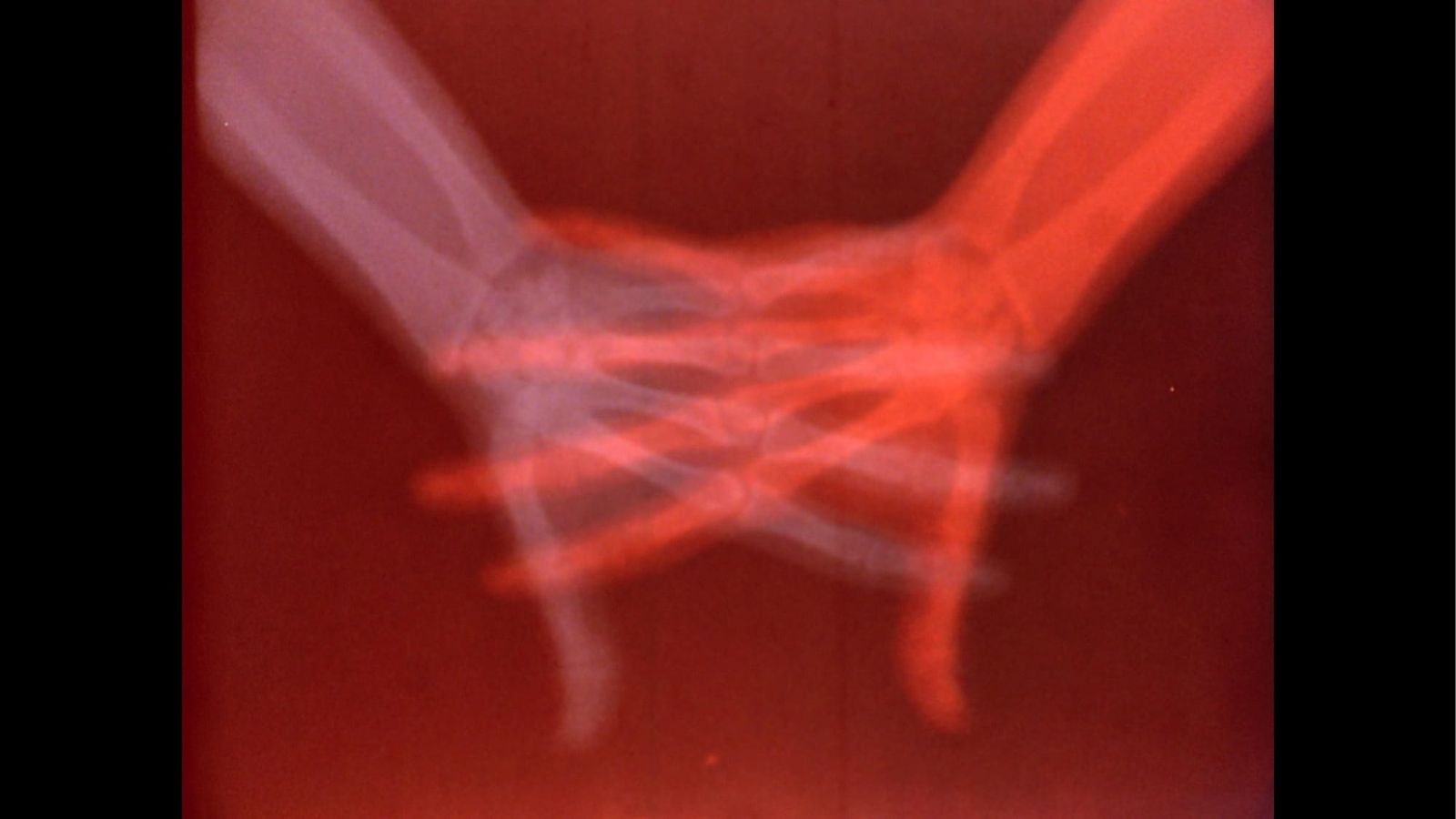 Arte e Imagem Médica: Exposição Revela Corpo Sob Nova Luz
