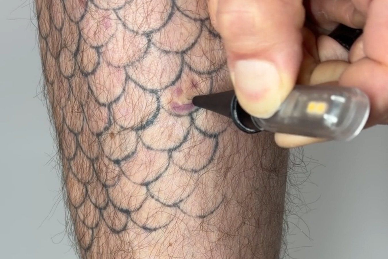 Tatuagens que acendem e apagam com luz abrem novas eras médicas e sociais