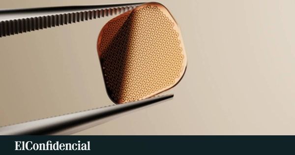 O olho biônico do ex-Neuralink chega à Europa. E agora?