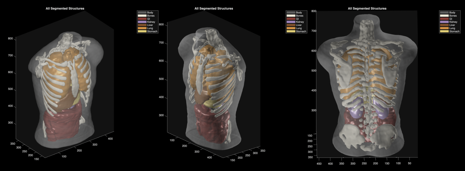 Midjourney troca geração de imagens por scanners médicos de imersão