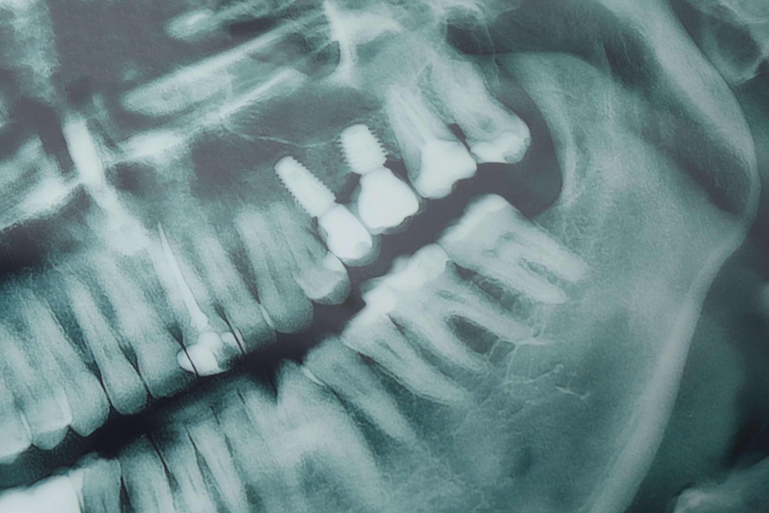 O novo colega do dentista: um algoritmo da USP