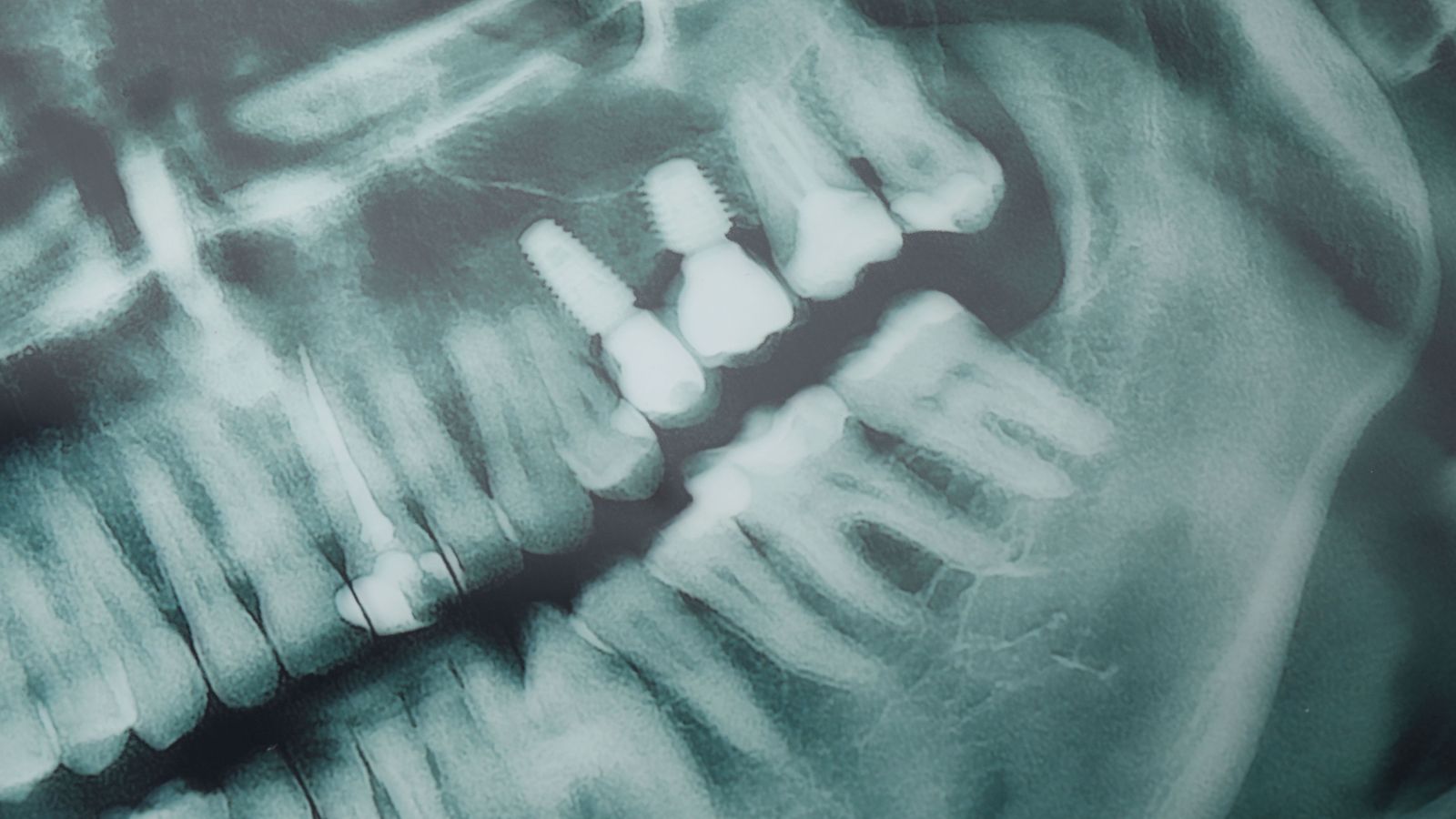 O novo colega do dentista: um algoritmo da USP