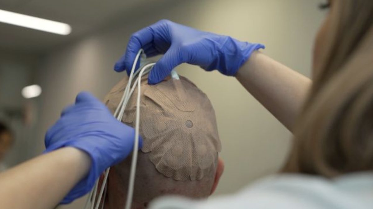 Hospital 12 de Outubro testa terapia combinada contra glioblastoma — nova esperança em fase 3