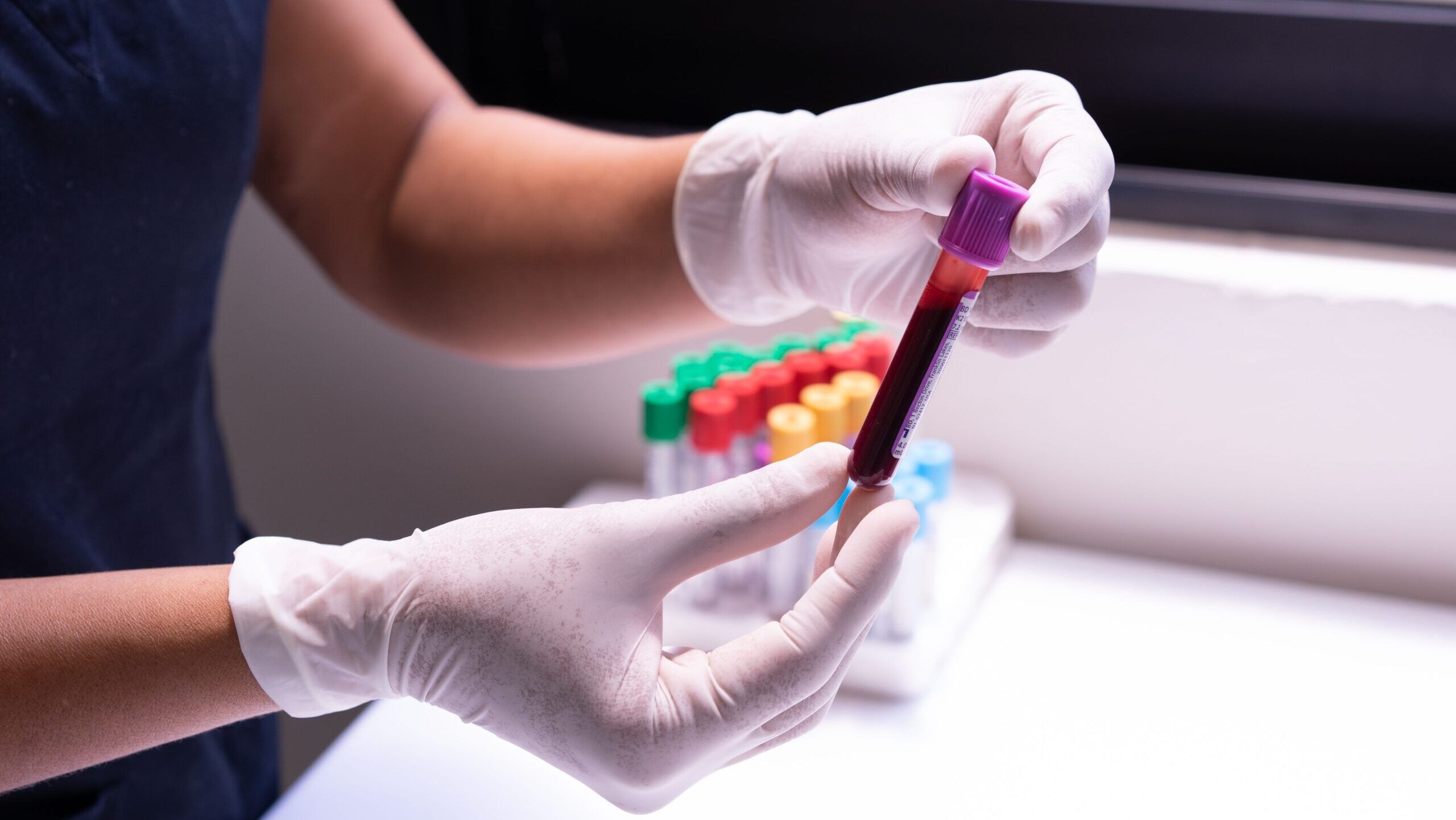 IA prevê risco de câncer com exames de sangue rotineiros