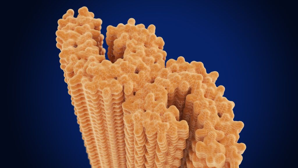 Biogen aposta na proteína tau para frear o Alzheimer