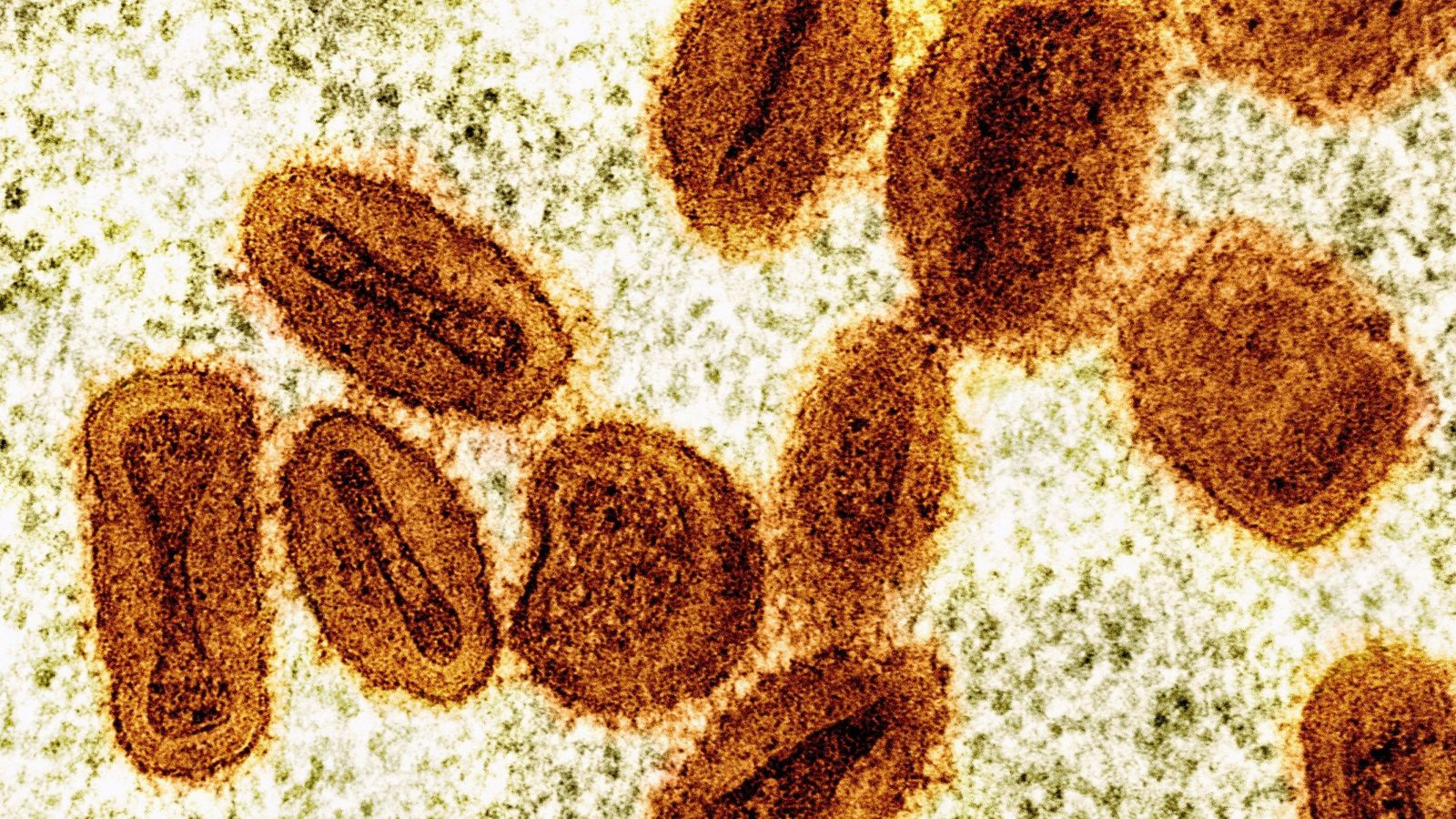 Virologistas do governo americano são acusados de contrabandear amostras de Mpox