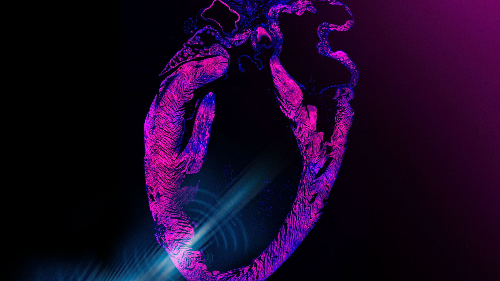 Engenheiros do MIT criam marca-passo via ultrassom — alternativa sem cirurgia