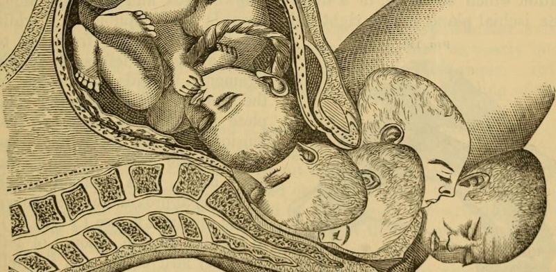 Parto e a arquitetura do tempo — como a obstetrícia moldou nossa percepção da dor
