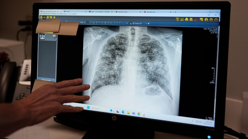 FDA concede selo de inovação a IA generativa em radiologia
